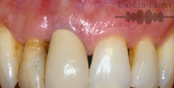 Evaluación clínica del color, aspecto, forma, separación, tamaño de dientes y encía.