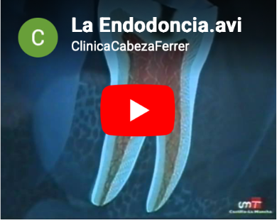 La endodoncia