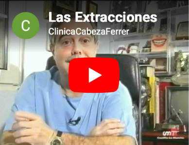 Las extracciones