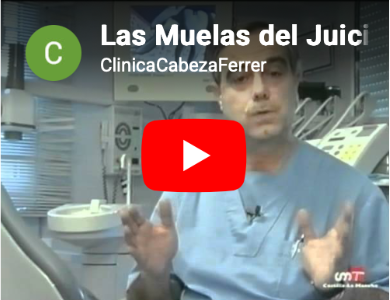Las muelas del juicio