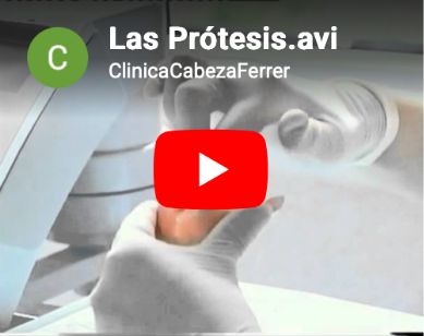 Las prótesis